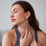 Alerjik Cilt Hastalıkları